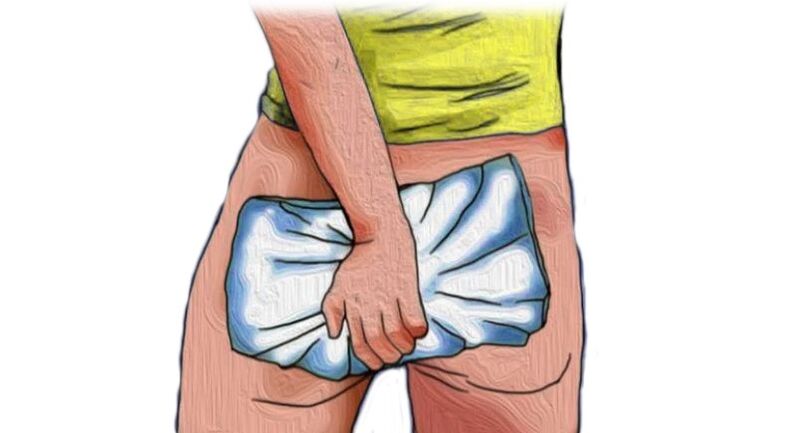 Sintomi spiacevoli delle emorroidi trattati dalla crema Proctonic
